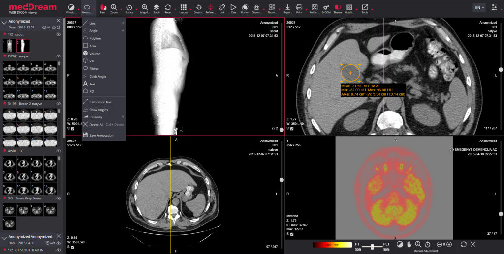 MedDream DICOM Viewer Radiology