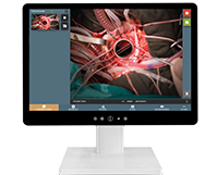 MedDream VideoStation Medical Video Recording Software