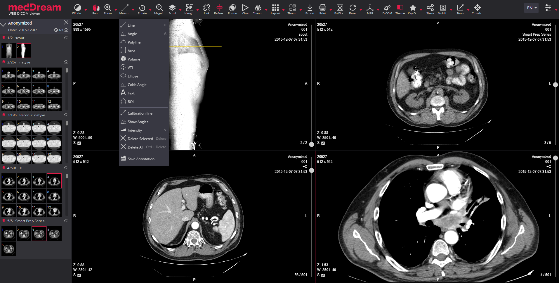 MedDream DICOM VIEWER Radiology features