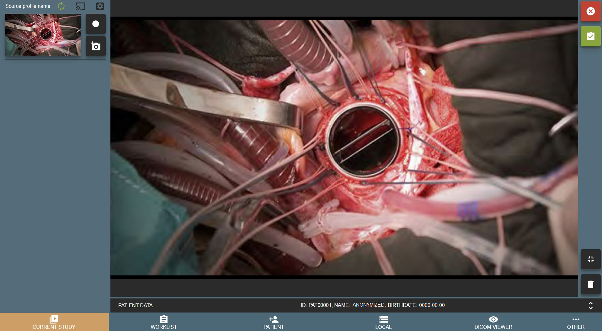 MedDream VideoStation Medical Video