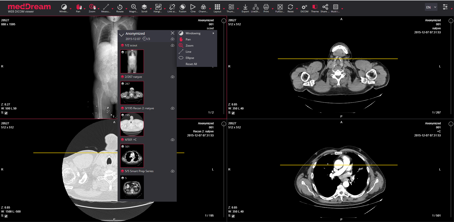 Thumbnail Icon For CT MR PET Series Quick Menu