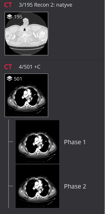 Thumbnails Phases Dicom Viewer