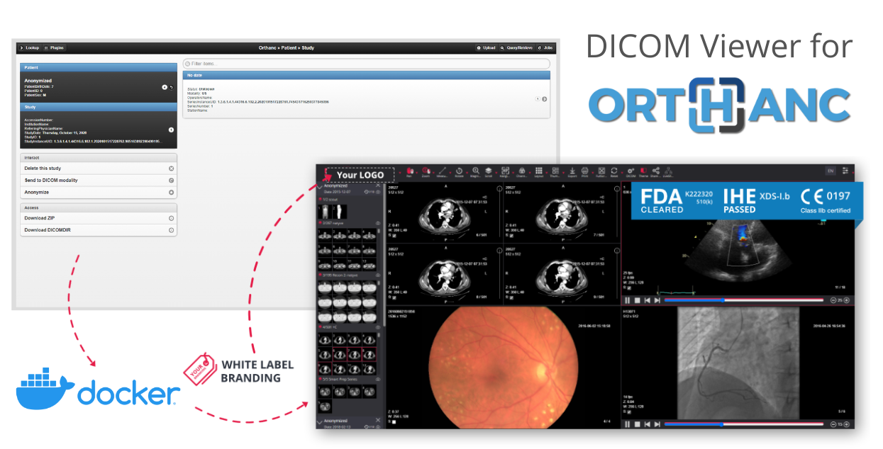 DICOM Viewer For Orthanc Pacs Open Source Pacs