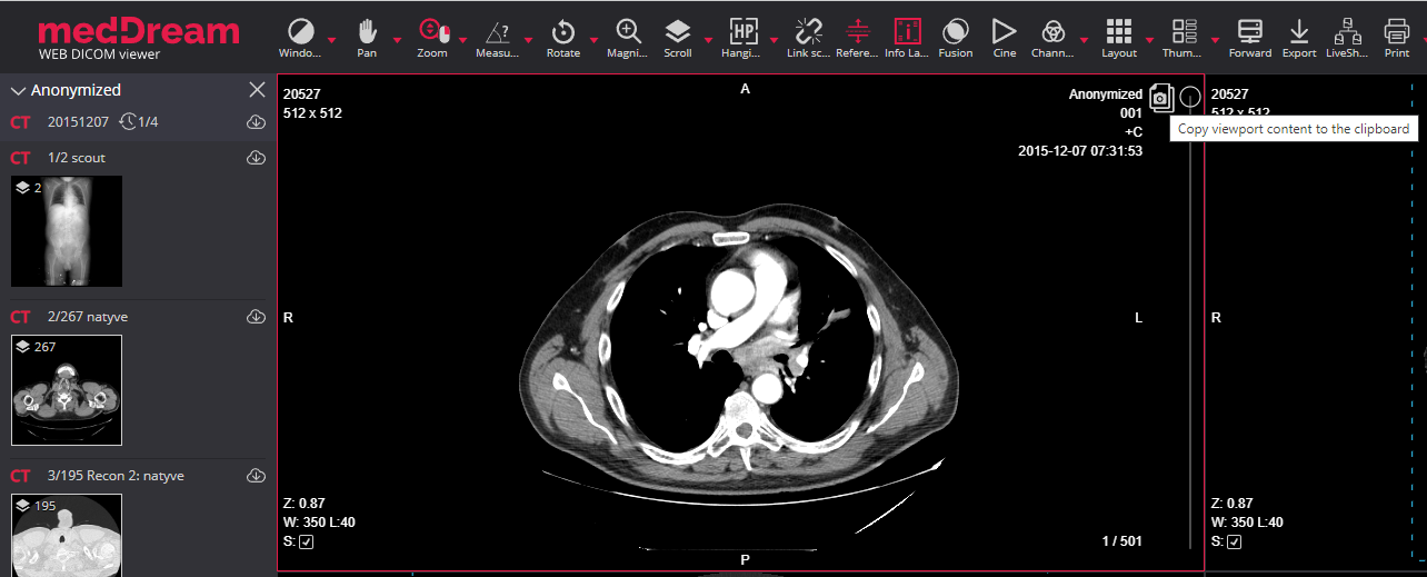 Copy Image To The Clipboard Dicom Viewer