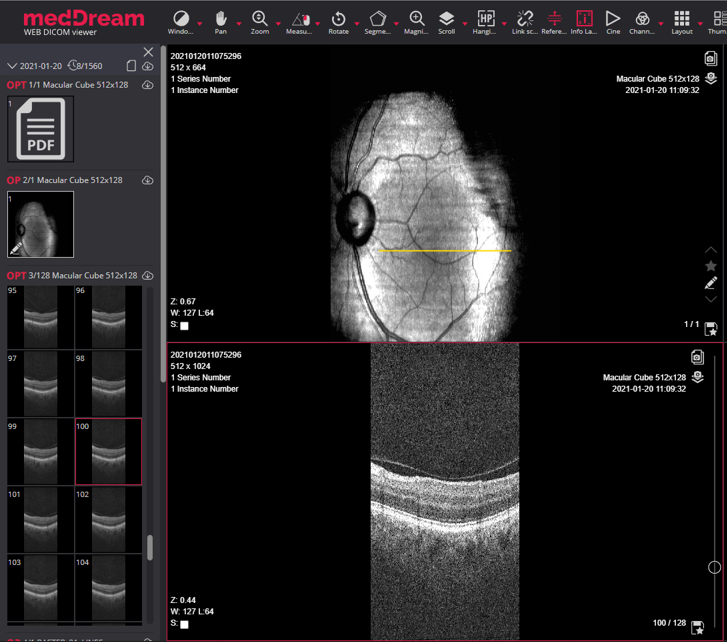 OP OPT Reference Line Dicom Viewer