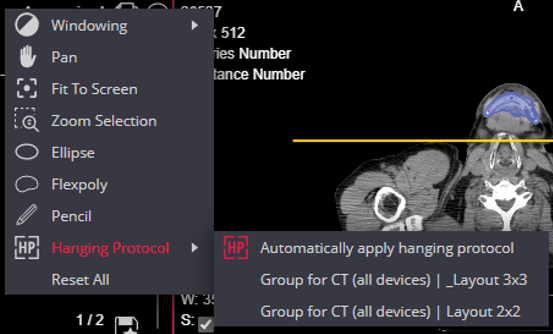 Quick Menu HP Dicom Viewer Hanging Protocols