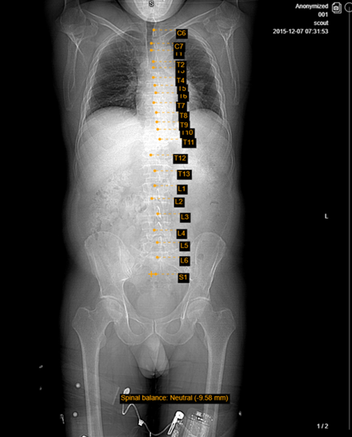 Spine Labeling Dicom Viewer