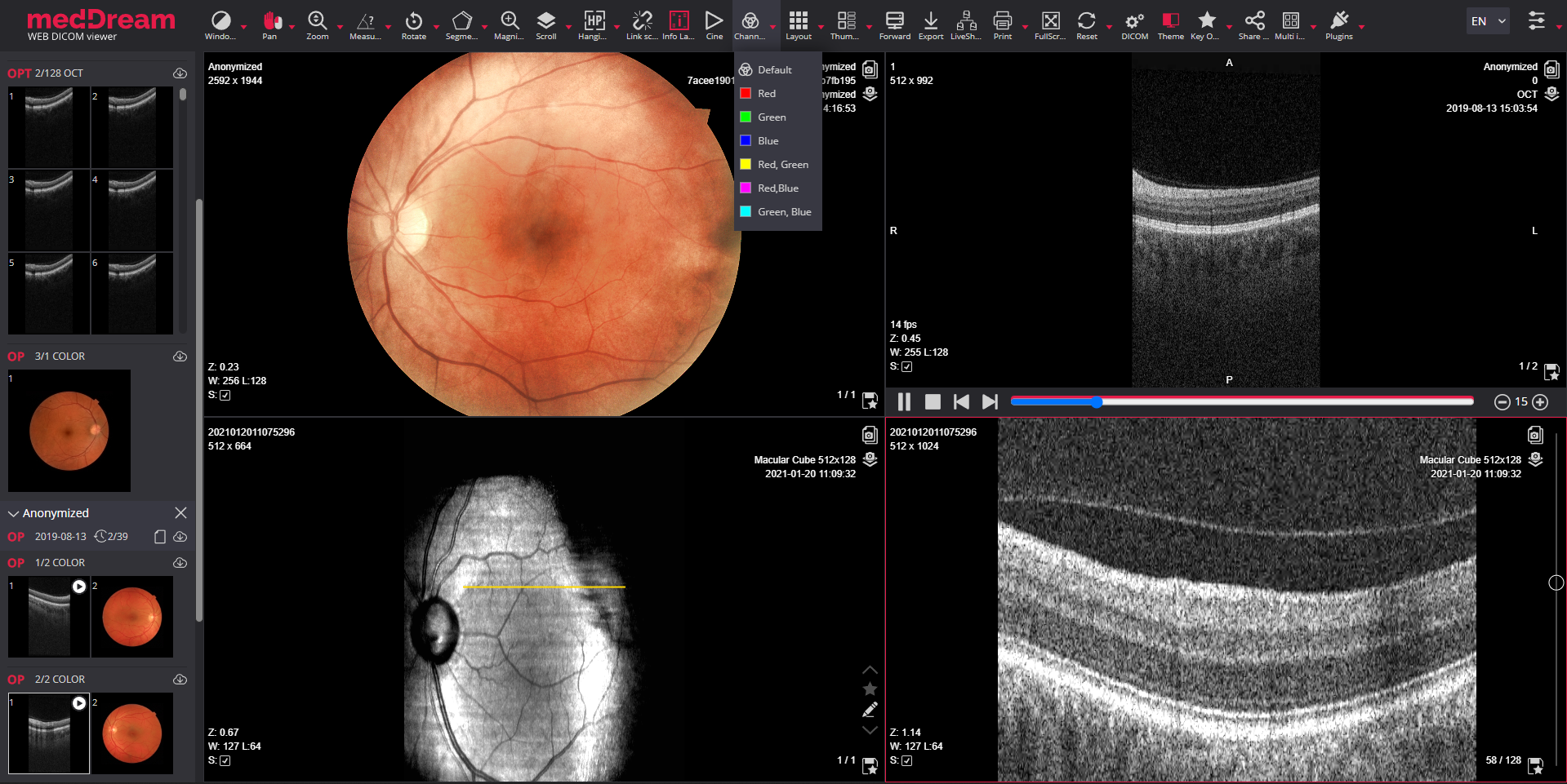 Ophthalmology Oct Opt Op Modalities Image Viewer Meddream
